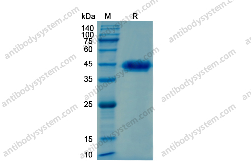 SDS-PAGE for Enterokinase ?>