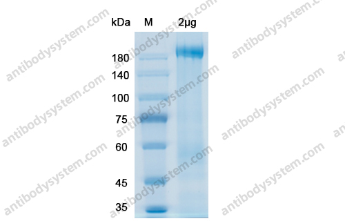 SDS-PAGE for Recombinant SARS-CoV-2 Spike - Trimer/S6P trimer Protein, C-His ?>