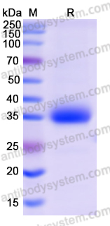 SDS-PAGE for Recombinant SARS-CoV-2 RBD (B.1.617.2) Protein, C-His ?>