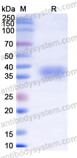 SDS-PAGE for Recombinant SARS-CoV-2 RBD (Omicron/BA.2) Protein, C-His ?>