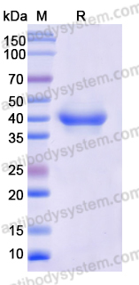 SDS-PAGE for Recombinant Monkeypox virus/MPXV B6R/SL-159 Protein, C-His ?>