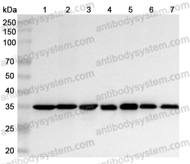 Anti-Human GAPDH Monoclonal Antibody (1A200)