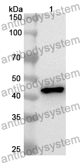 Western Blot for Anti-Human CK-MB Polyclonal Antibody ?>