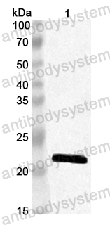 Anti-CA16 Protease 3C Polyclonal Antibody