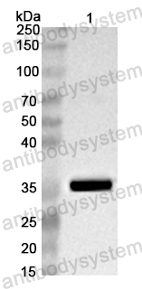 Anti-Coxsackievirus A10 VP1/Capsid protein VP1 Polyclonal Antibody