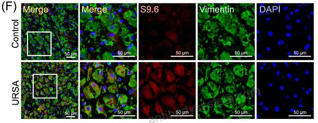 IF for Anti-DNA-RNA Hybrid Antibody (S9.6) ?>