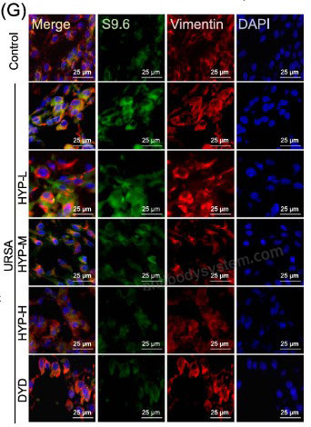 IF for Anti-DNA-RNA Hybrid Antibody (S9.6) ?>
