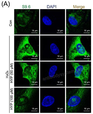 IF for Anti-DNA-RNA Hybrid Antibody (S9.6) ?>