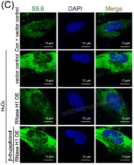 IF for Anti-DNA-RNA Hybrid Antibody (S9.6) ?>