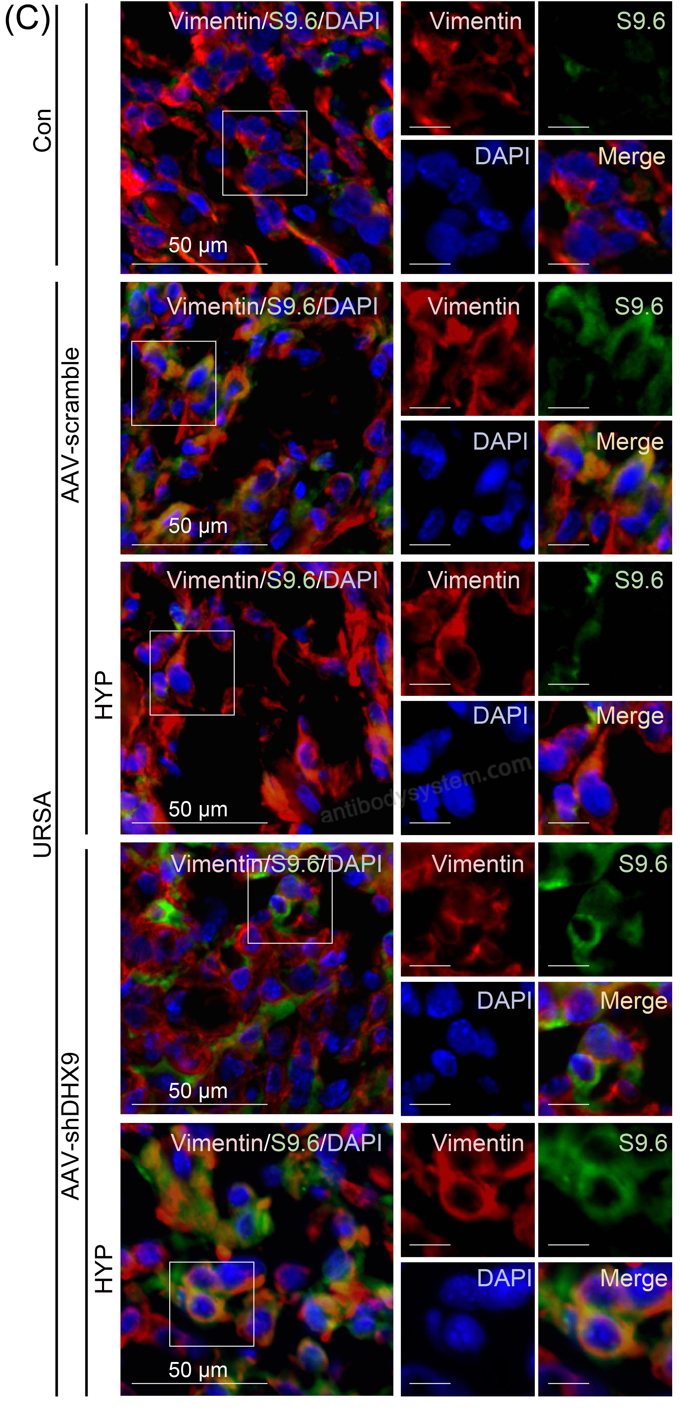 IF for Anti-DNA-RNA Hybrid Antibody (S9.6) ?>