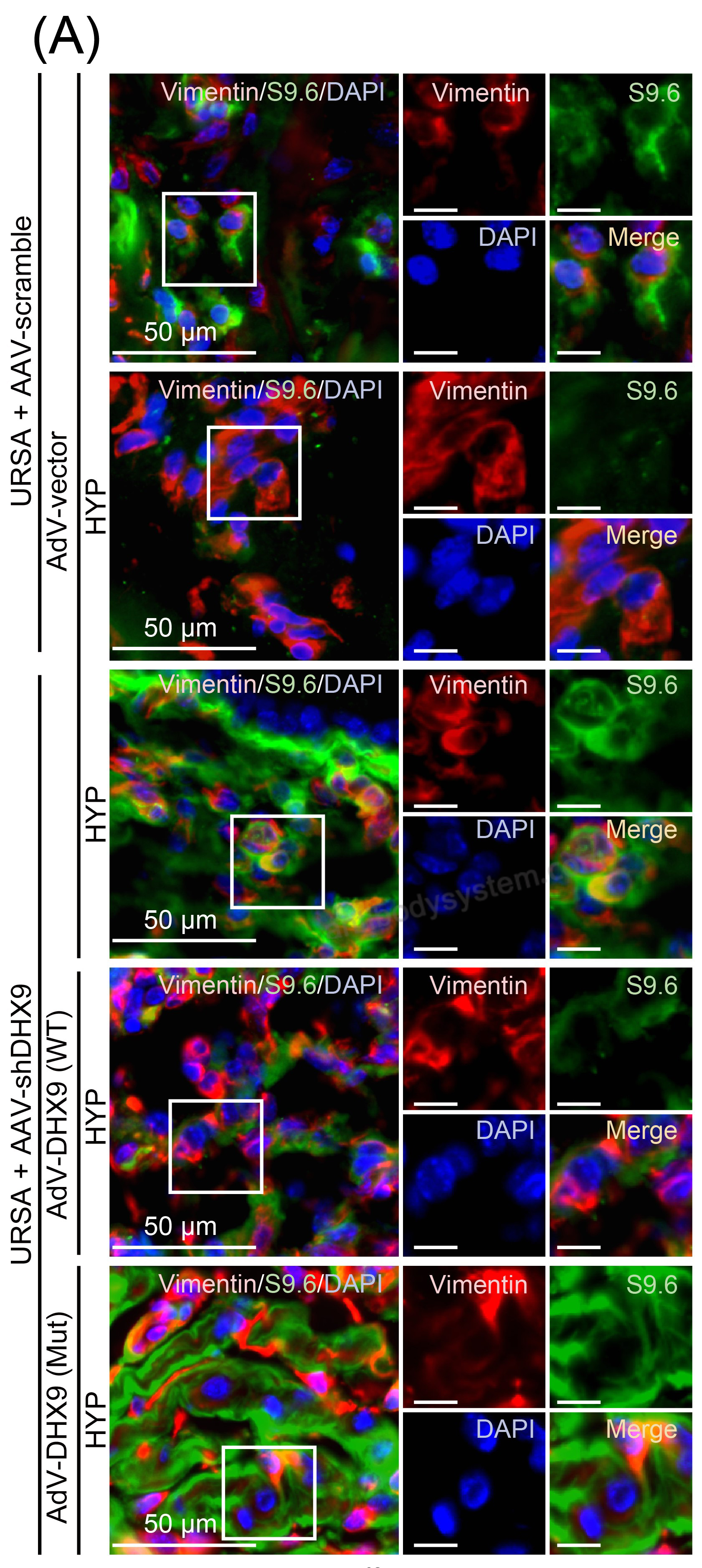 IF for Anti-DNA-RNA Hybrid Antibody (S9.6) ?>