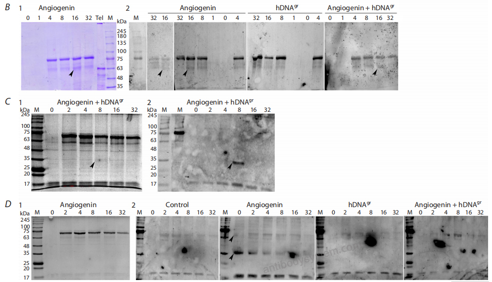 Western Blot for Anti-Human TERT Antibody (SAA1735) ?>