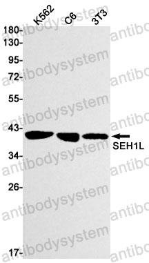 Western blot for Anti-SEH1L Antibody (R2T08) ?>