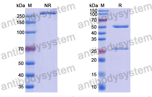 Anti-Clostridium perfringens pfo/Perfringolysin O/Theta-toxin Antibody (HS3)