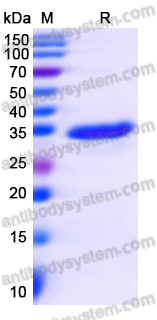 SDS-PAGE for Recombinant Human TCOF1 Protein, N-GST & C-His ?>