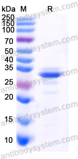 Recombinant Human CD274/PD-L1/B7-H1 Protein, N-His