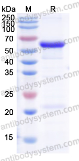 SDS-PAGE for Recombinant Human VASH2/Vasohibin-2 Protein, N-His-SUMO ?>