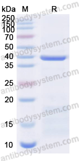 SDS-PAGE for Recombinant Mycoplasma pneumoniae mgpA/Adhesin P1 Protein, N-His ?>