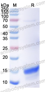 Recombinant Streptococcus pyogenes M protein type 1 Protein, N-His