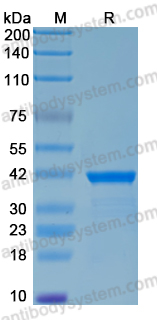 Recombinant Streptococcus pyogenes arp4/IgA receptor Protein, N-His